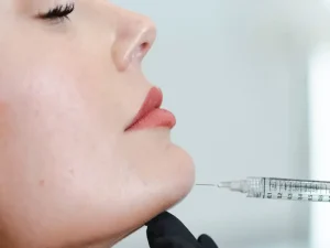 تزریق فیلر چانه